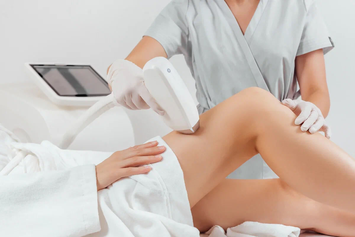 Лазерная эпиляция 1